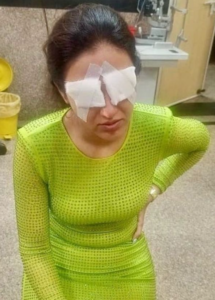 Jasmin Bhasin Eye Injury: Corneal Damage Revealed, What Happened at the Delhi Event?